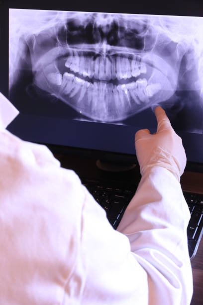 Best Emergency Treatment for Toothache in Apalachin, NY